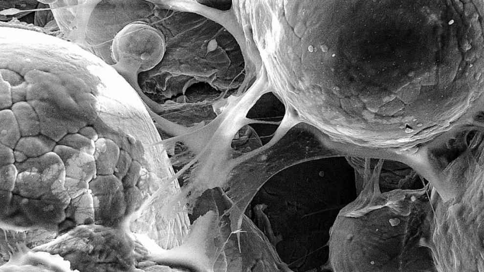 This image shows cells adhering to a titanium alloy created by cold-spray 3D printing, which demonstrates the material’s biocompatibility.